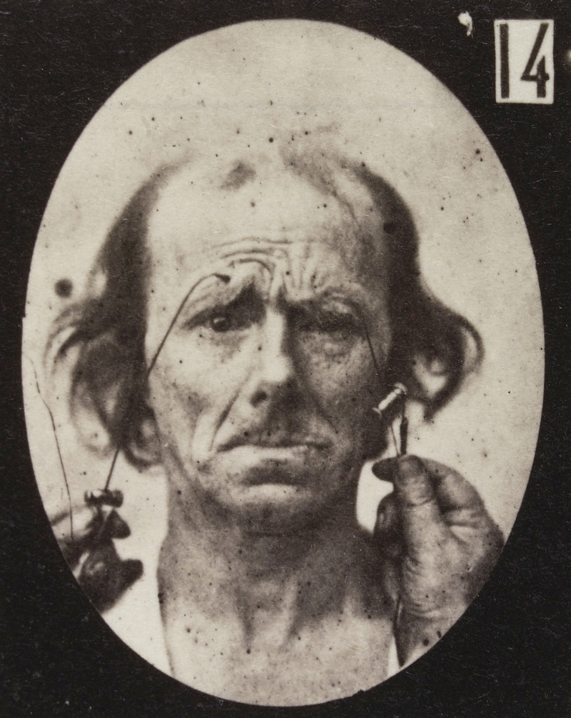 Illustration for article titled Terrifying, Century-Old Photographs from Neuroscience Experiments